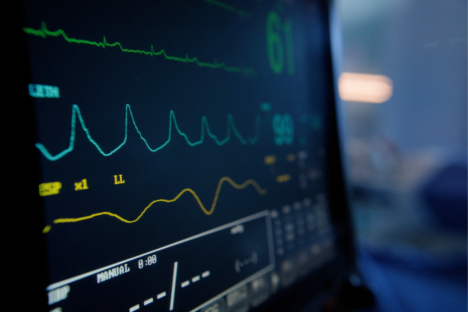 An active EKG machine monitoring a patient